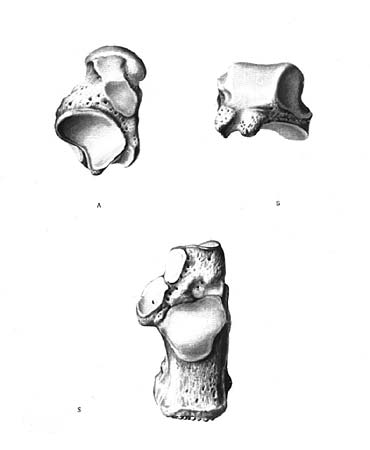 иллюстрация к разделу: Таранная кость